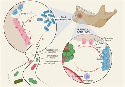 Mechanisms of bone remodeling and therapeutic strategies in chronic apical periodontitis